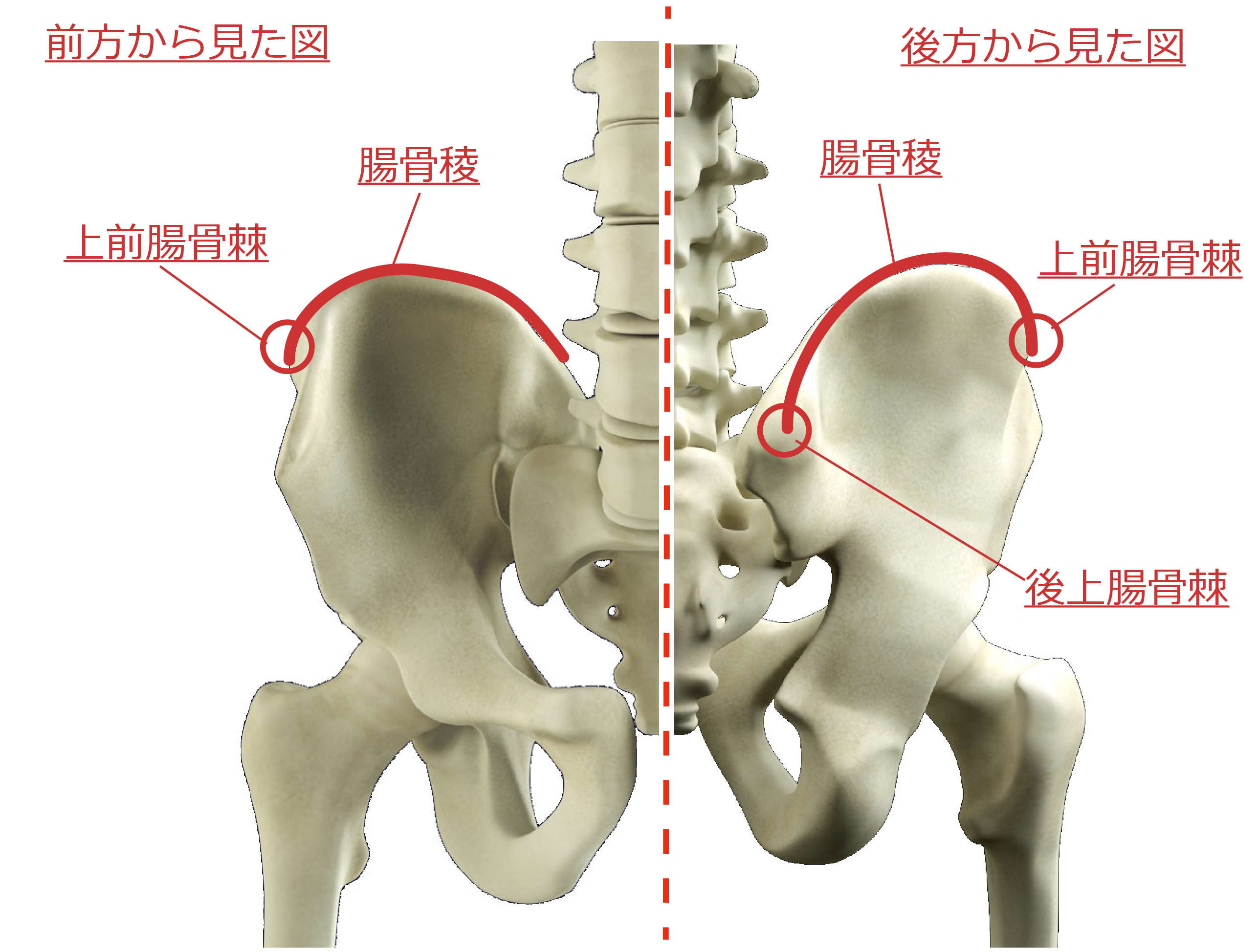 左 の 腰骨 が 痛い